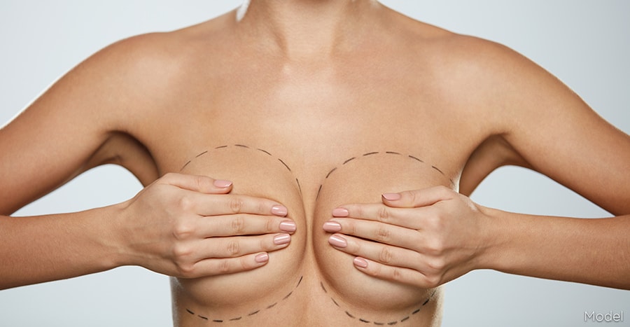 The Miami Glow-Up: Mastering the Art of Breast Augmentation