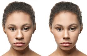 Respecting Heritage: Ethnic Rhinoplasty in Los Angeles