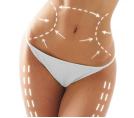 Stunning Tummy Tuck Results: Miami’s Success Stories